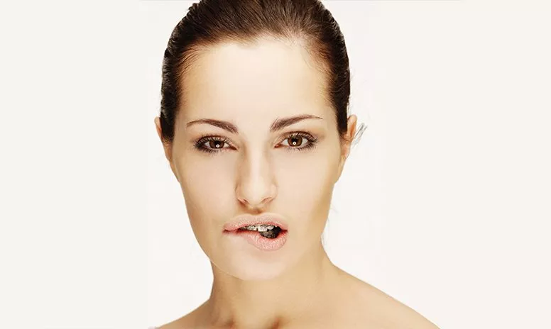Erwachsene Frau mit Zahnspange