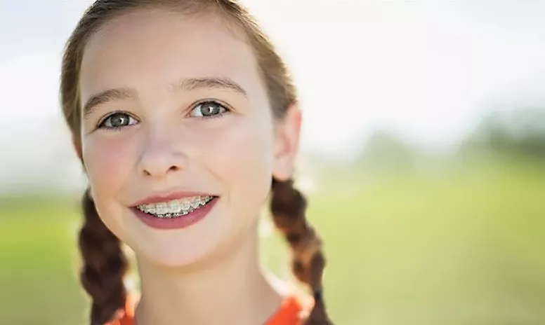 Lächelndes Mädchen mit fester Zahnspange mit Keramikbrackets 